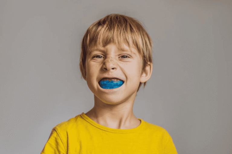 Custom Mouthguards