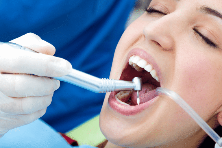 Fillings